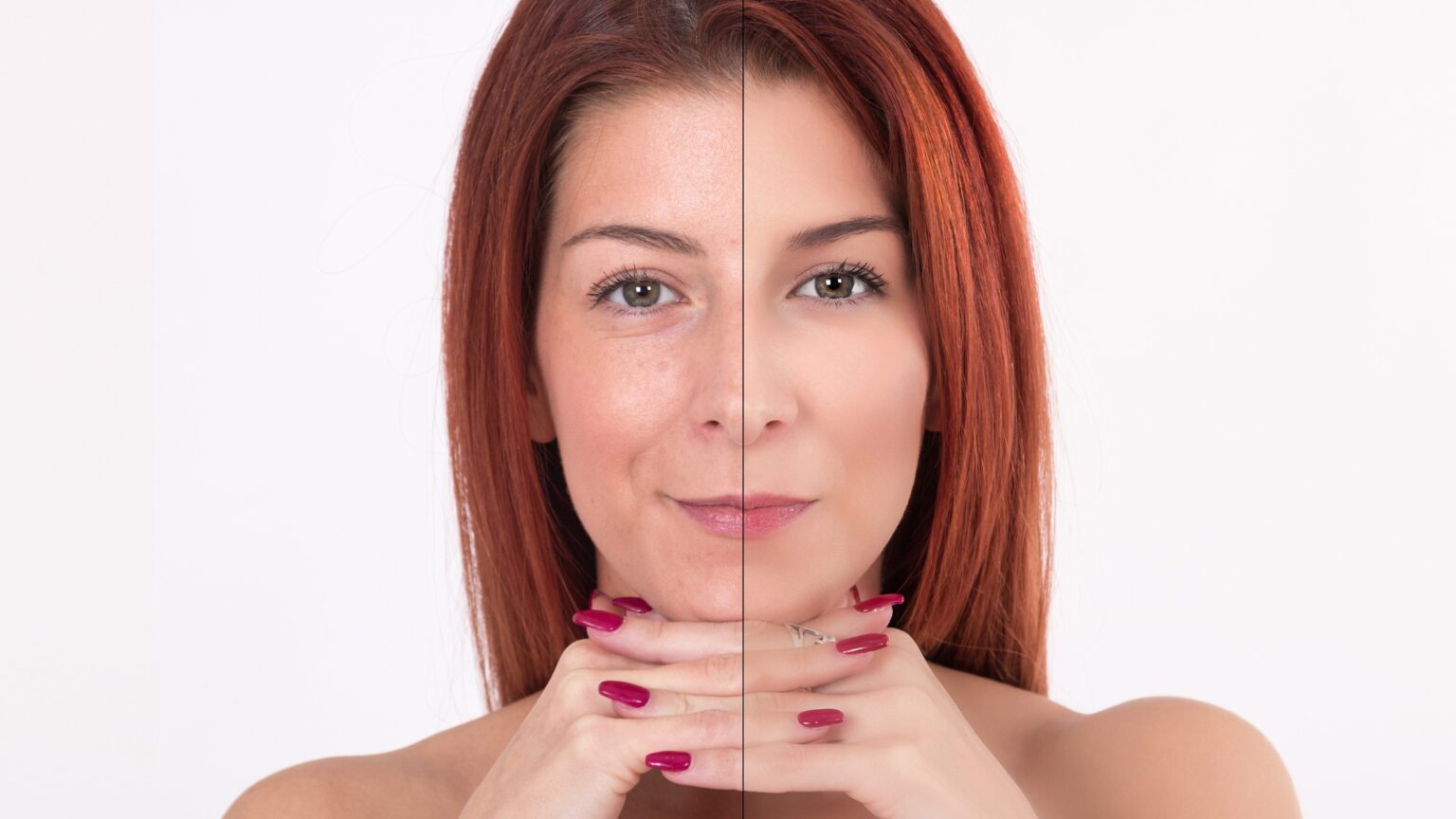 mulher mostrando antes e depois da pele