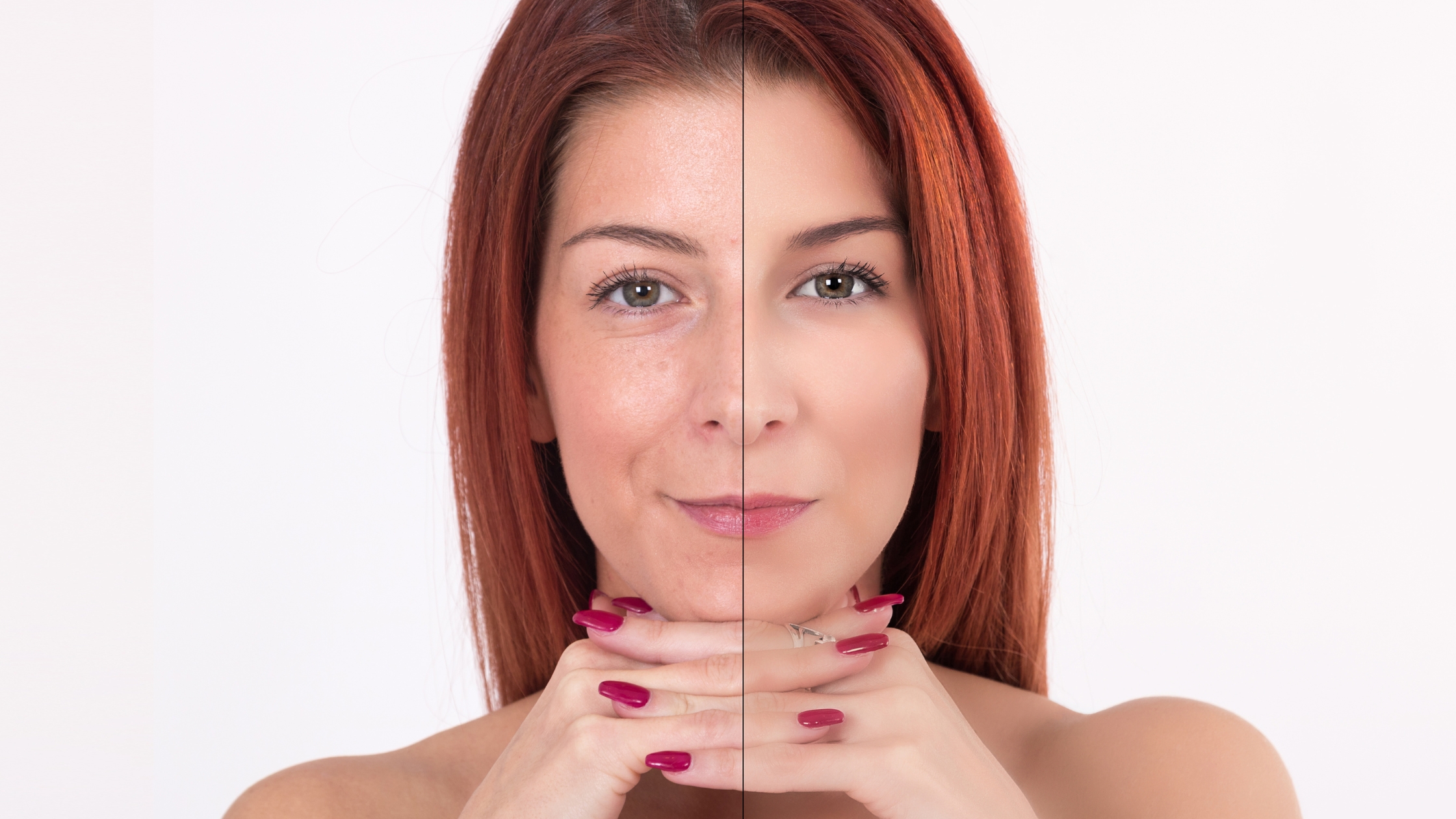 mulher mostrando antes e depois da pele